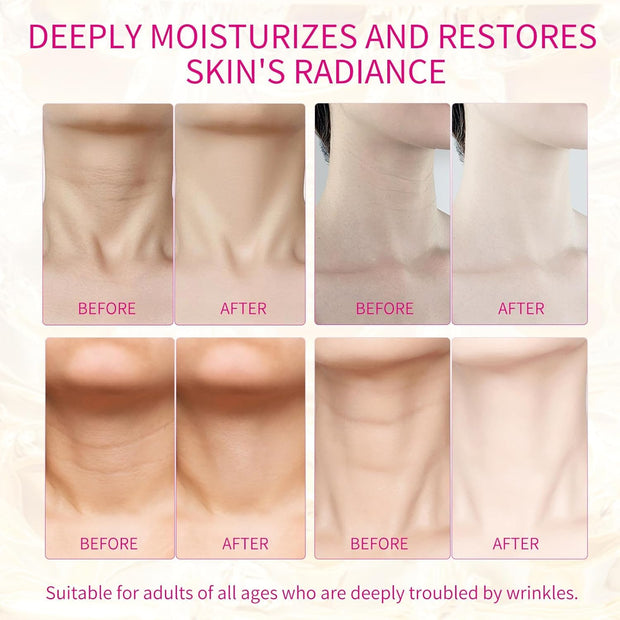 5 PCS Silicone Neck Wrinkle Patches, Reusable Overnight Anti-Wrinkle Patches, Anti Aging Silicone Wrinkle Patches for Skin Firming & Neck Tightening Wrinkles (1.5 month Supply)